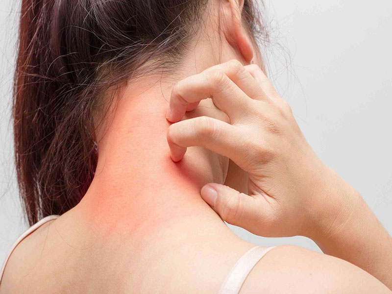 Nệm Ngủ Ngon - Bị ngứa khi nằm trên giường nệm, nguyên nhân do đâu?