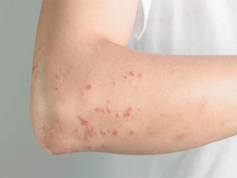Nệm Ngủ Ngon - Những tác hại nguy hiểm không ngờ khi thời tiết quá nóng