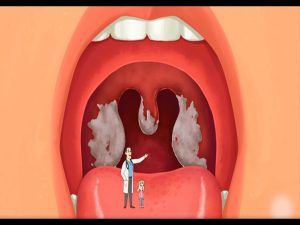 Nệm Ngủ Ngon - Bệnh bạch hầu - Đường lây truyền và cách phòng tránh